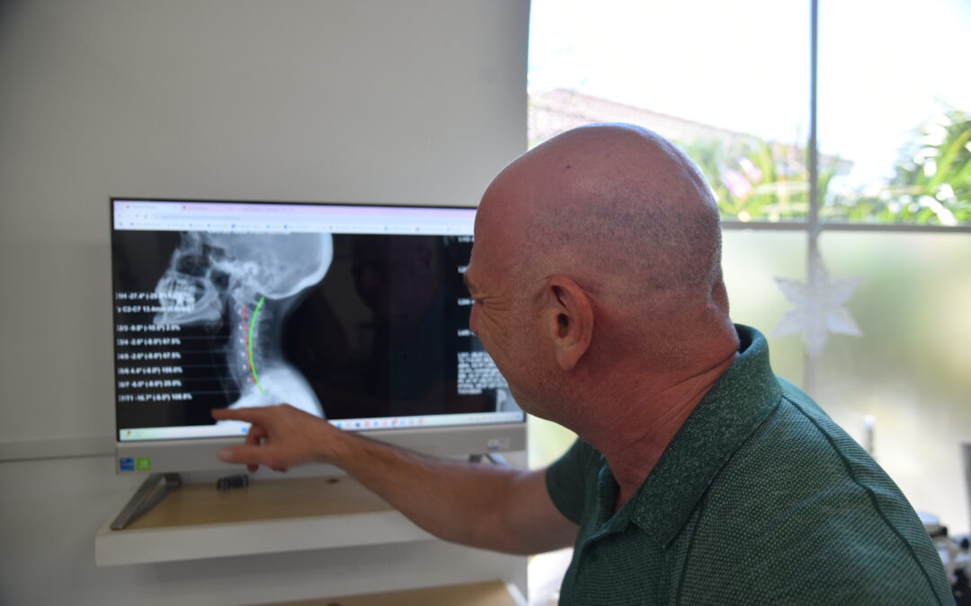 Trigger Point Therapy Workshop: Relieve Pain at the Source